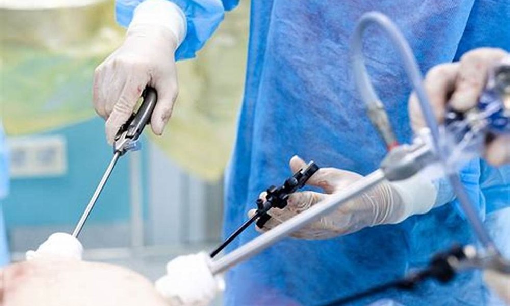 لاپاراسکوپی کلیه