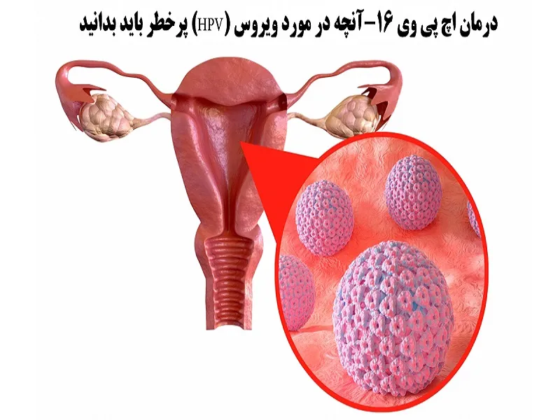 ویروس HPV 16